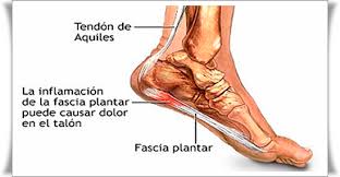 fascia plantar masajes León